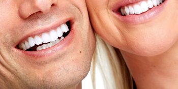 Albire dentară profesională în clinica stomatologică Dent House